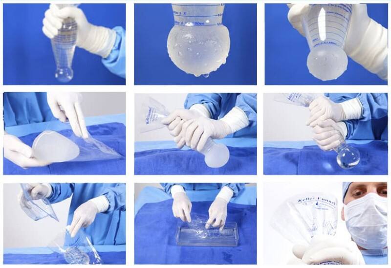 breast implant funnel-0