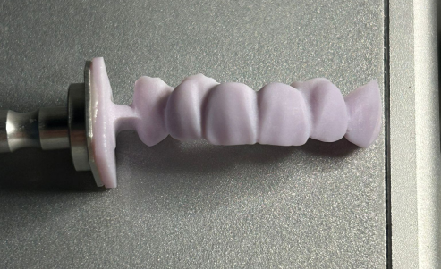 B40 Ultra-Tough  All-Ceramic Bridge · Solid Guarantee for Digital Restoration