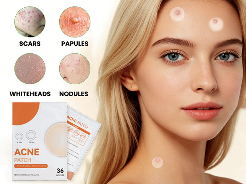 Აკნეს პლასტირი: ხილული გამარჯვების მომტანელი გასუფთავებული კანის სწრაფად მისაღებად