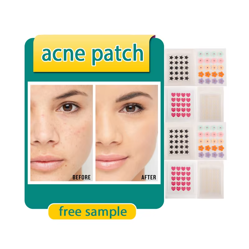 How to Choose Acne Patch for Fast Pimple Healing?
