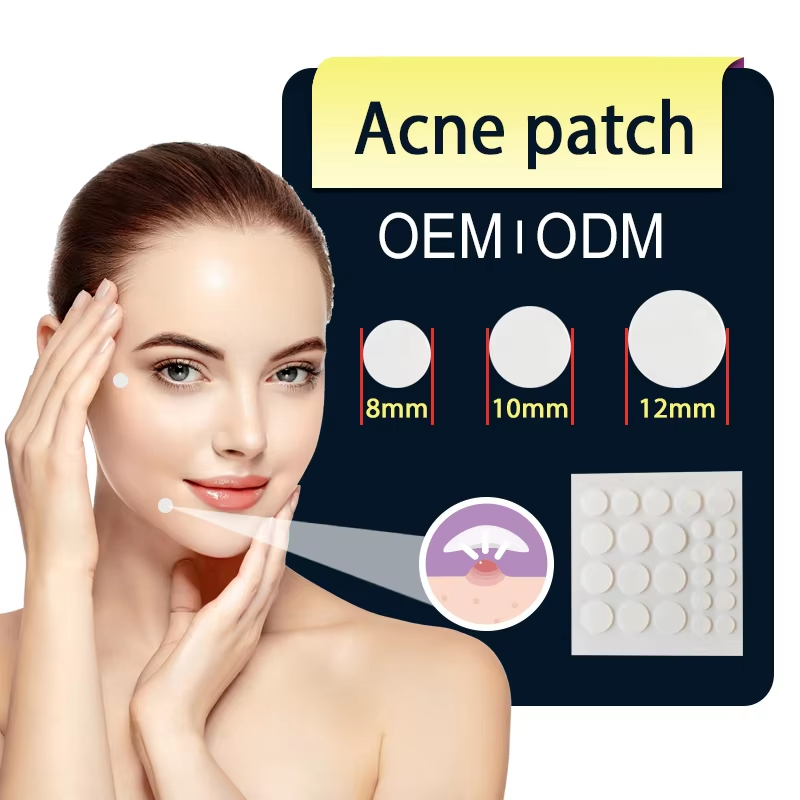 How to Get Rid of Acne Effectively? Acne Patch Is the Answer