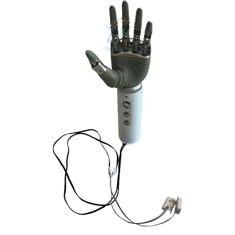 How to Choose the Right Myoelectric Hand for You