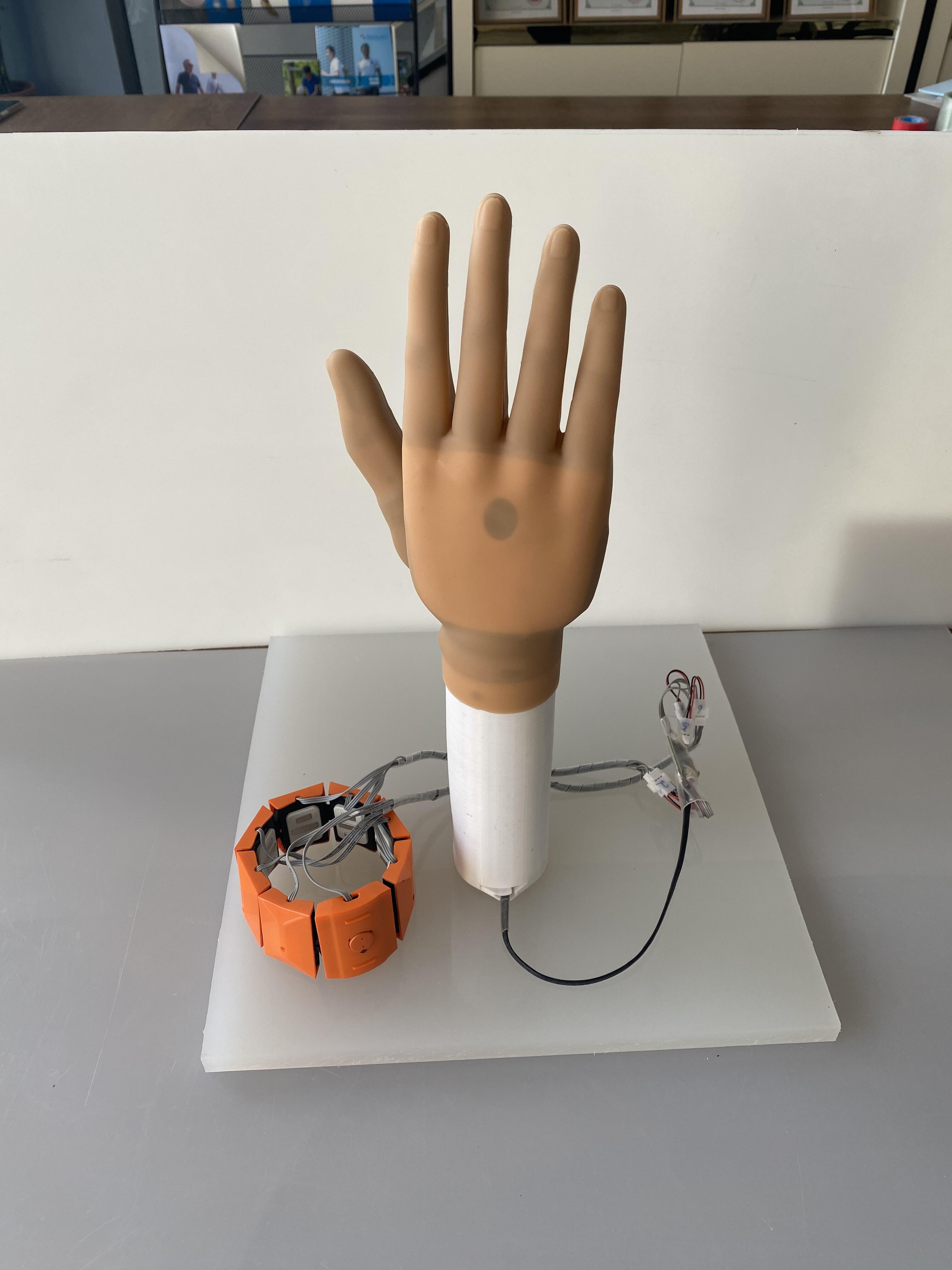 မိုင်အိုးလက်ထရစ်လက်များက ဘဝများကို မည်သို့ပြောင်းလဲနေပုံ