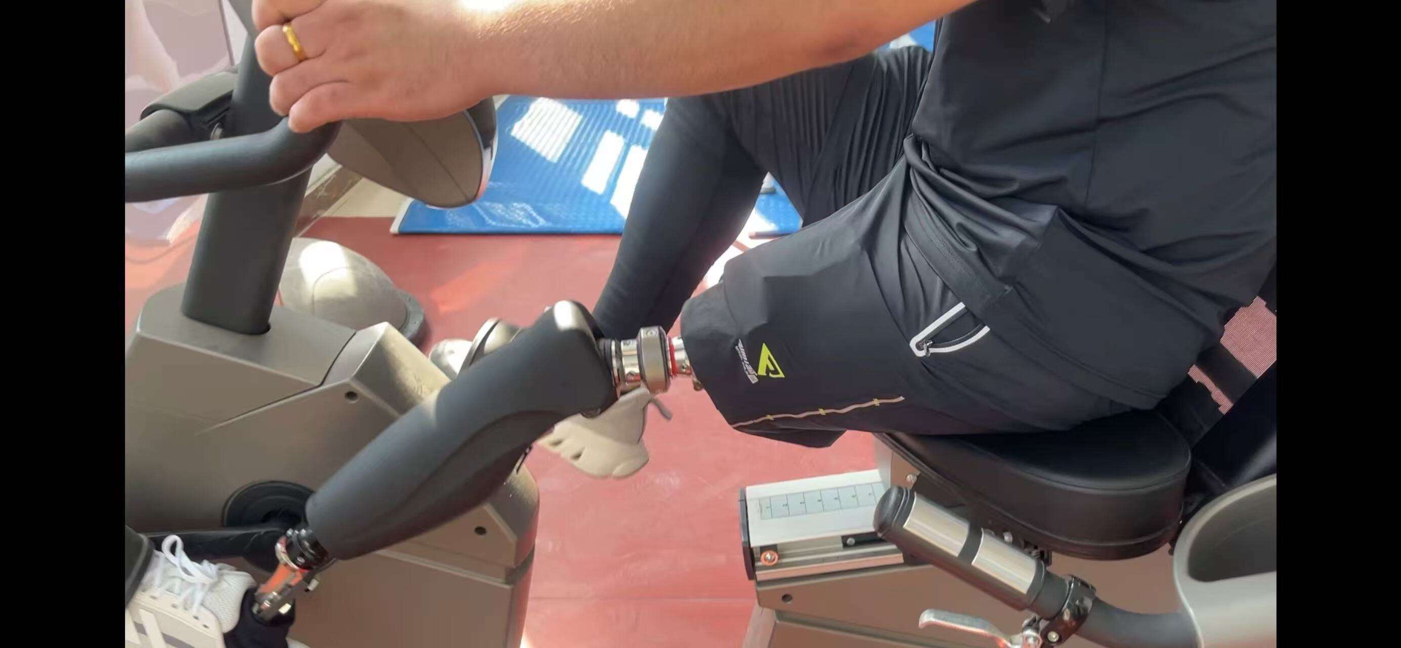 Достижения в области бионических коленных суставов для улучшения функциональности