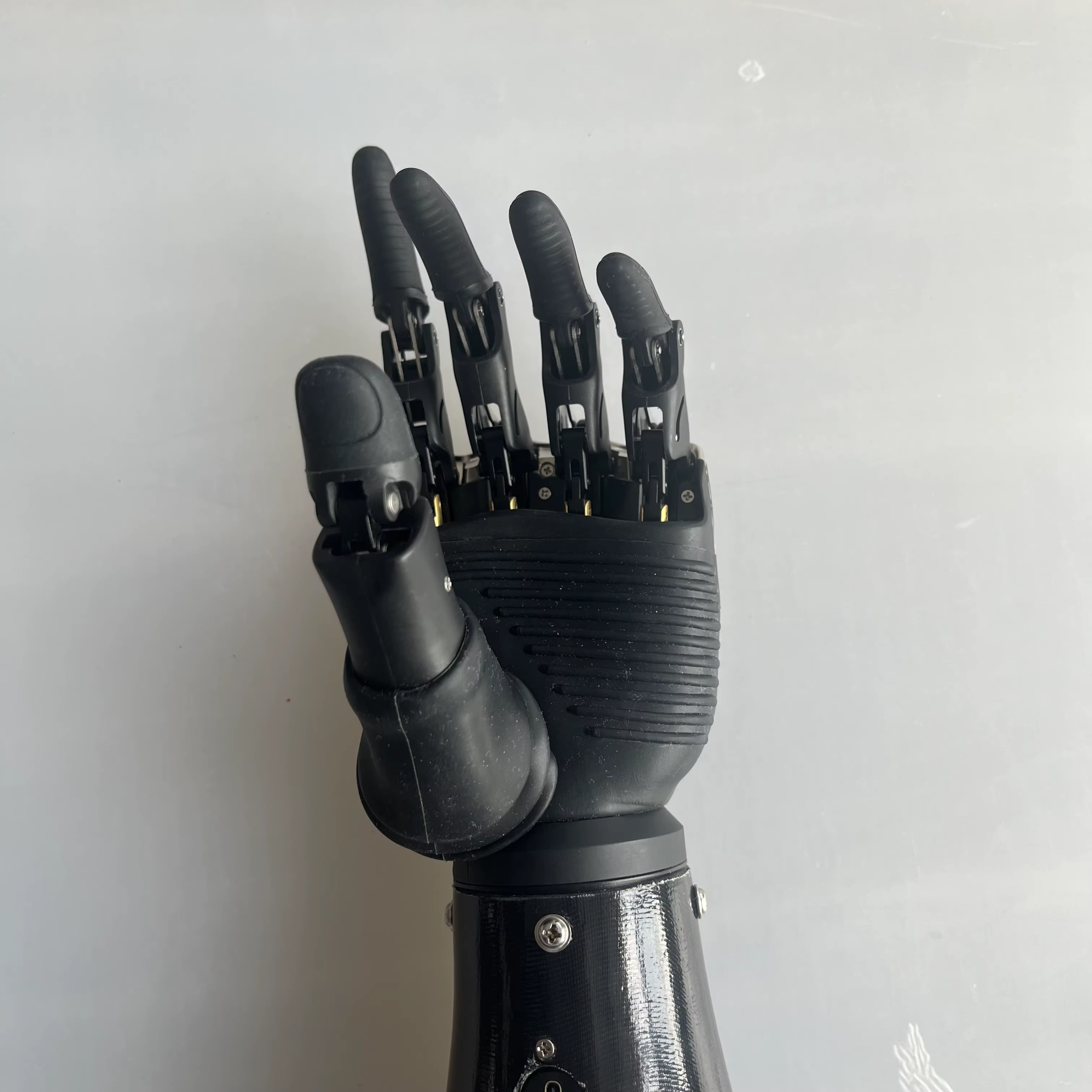 Why Bionic Hands Are the Future of Prosthetics