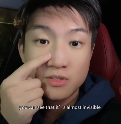 Stay Comfortable and Confident: The Invisible Benefits of Transparent PE Nasal Strips