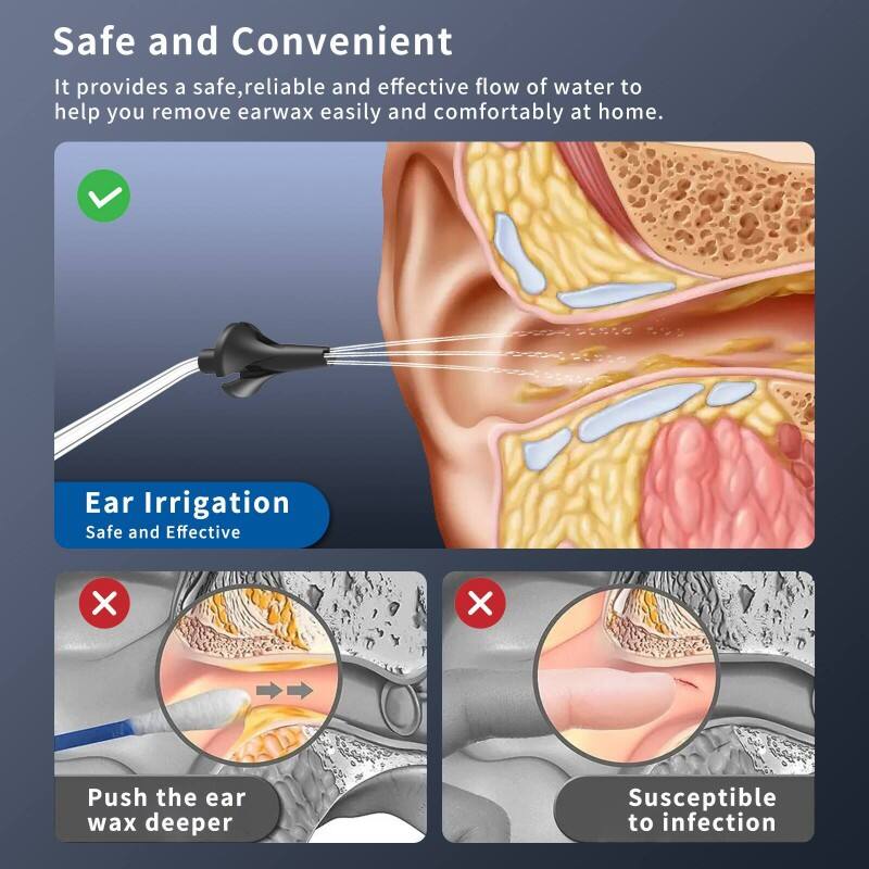 Wireless Visual Ear Cleaner with Camera: An Up-to-Date Answer for Ear Hygiene