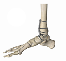 Comprehensive Surgical System with Intuitive Instrumentation