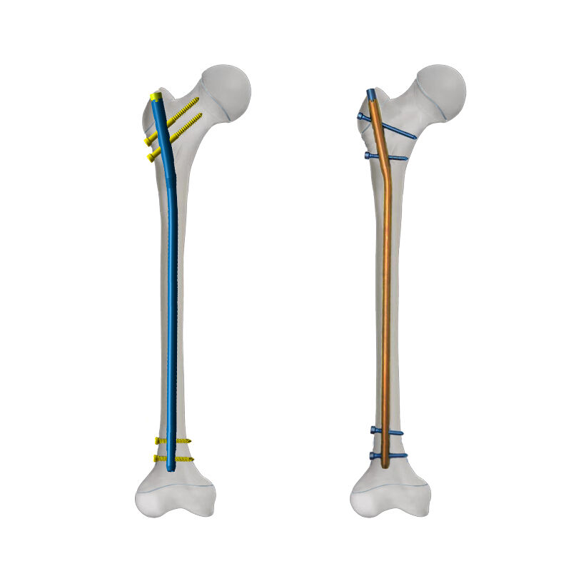 Minimally Invasive Surgical Approach