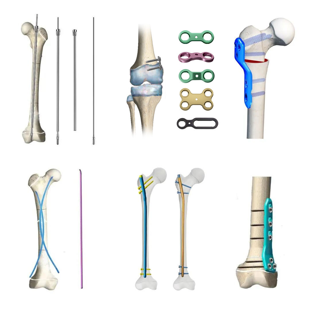 Designuri anatomic conturate pentru potrivire optimă
