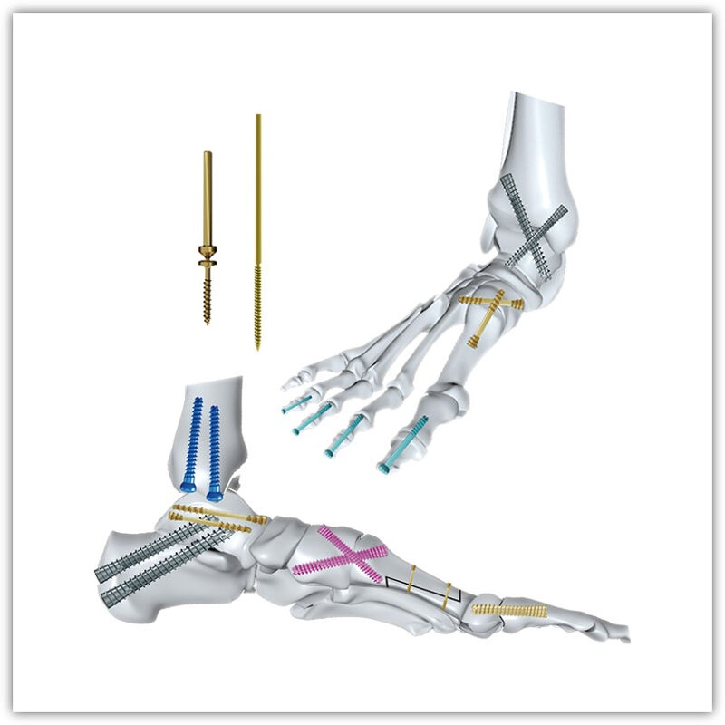 https://shopcdnpro.grainajz.com/category/83036/2966/967975016dce24818e62045b24477d0d/Pins%26Screws.jpg