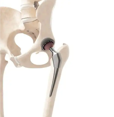 Comprehensive Instrumentation Sets for Surgical Versatility