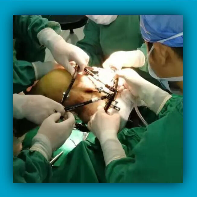 Bone Deformity Correction Surgery