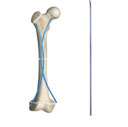 The Unique Challenges of Pediatric Fracture Management