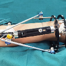 Yleiset komplikaatiot ja hoitomenetelmät ulkoisissa kiinnityskehyksissä leikkauksen aikana