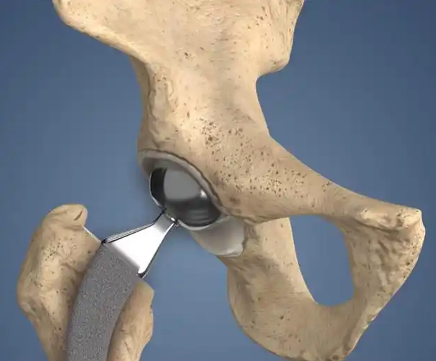 Ergonomic Design Reducing Surgical Team Fatigue