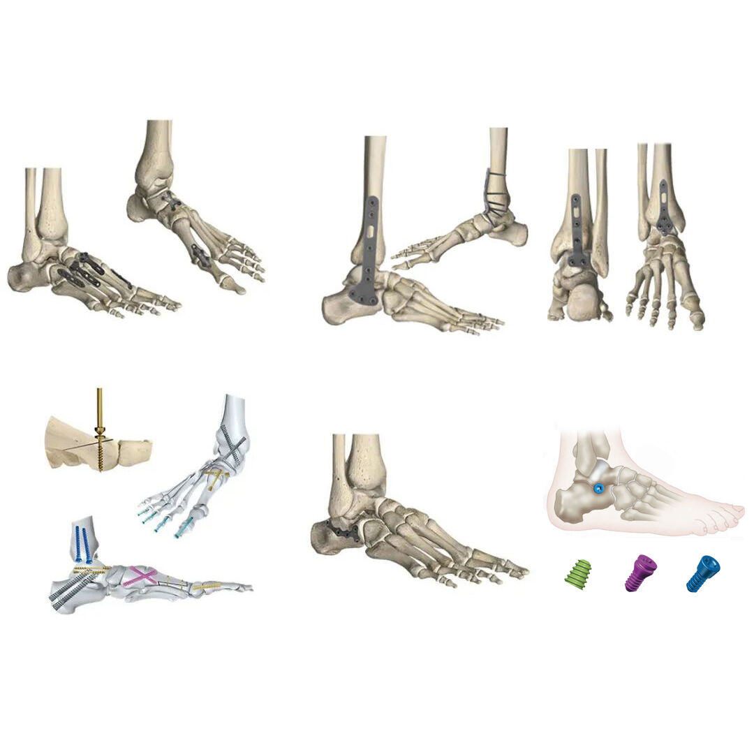Precision Instrumentation for Enhanced Surgical Accuracy