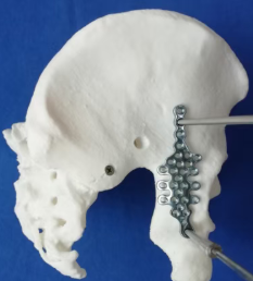 Biocompatible Materials for Long-Term Integration