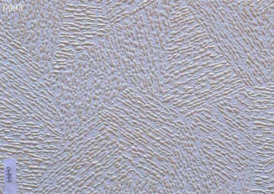 How to Maintain and Clean Gypsum Drop Ceiling Tiles for Longevity?