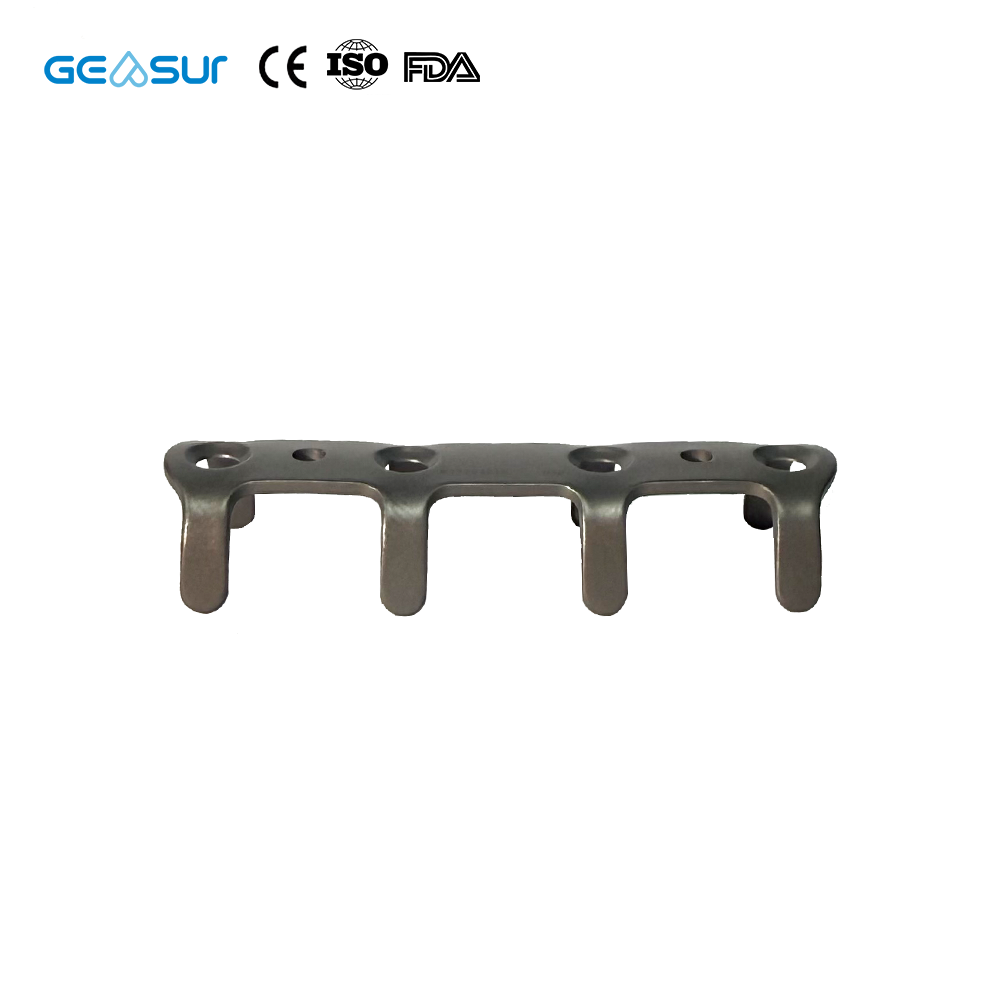 Geasure Rib Plate: Superior Solution for Rib Fracture Repair