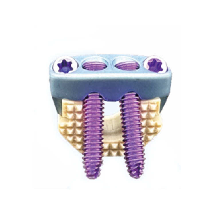 Innovative Threaded Design for Enhanced Stability