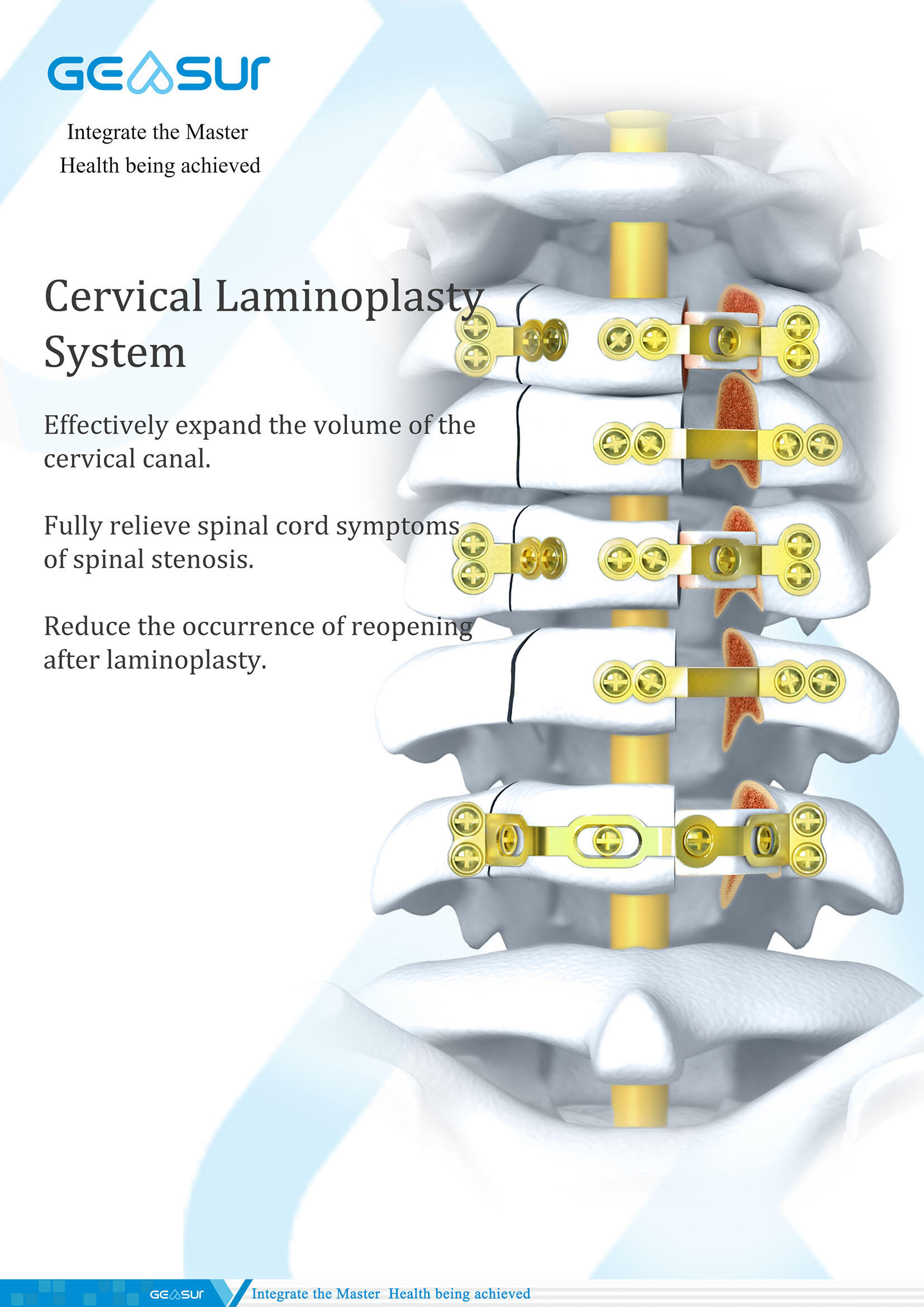 颈椎成型正 副本.jpg