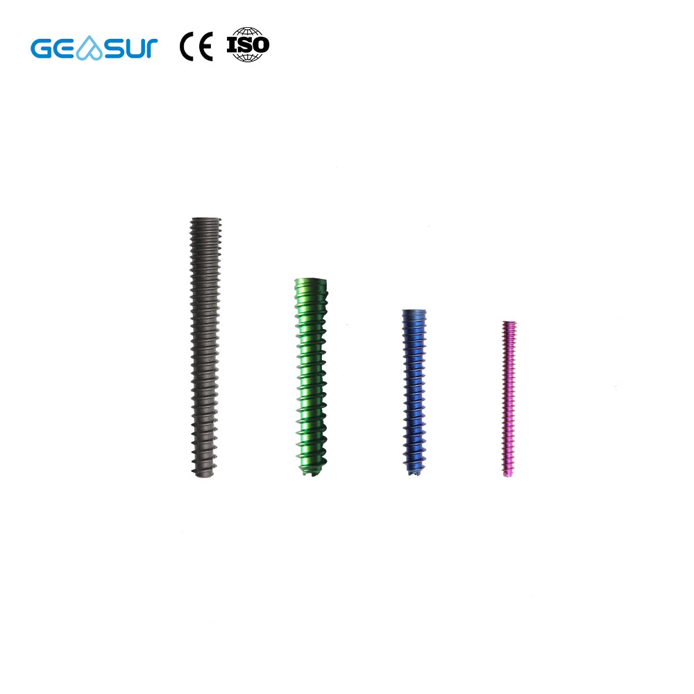 Geasure Cannulated Screws with Anti Loosening Feature Ensuring Fixation Stability