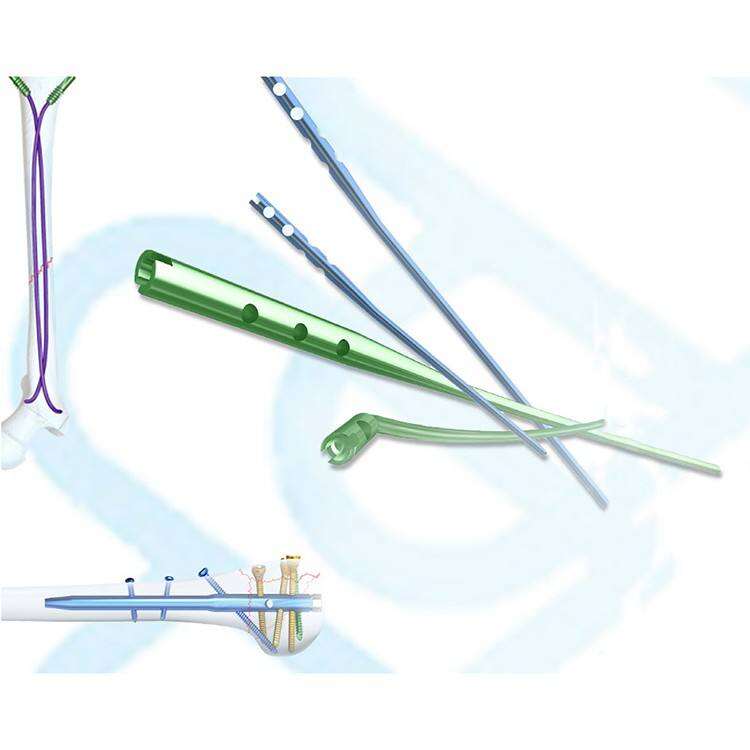 ข้อได้เปรียบที่เหนือกว่าของการผ่าตัดด้วยหมุดยึดในโพรงไขกระดูก