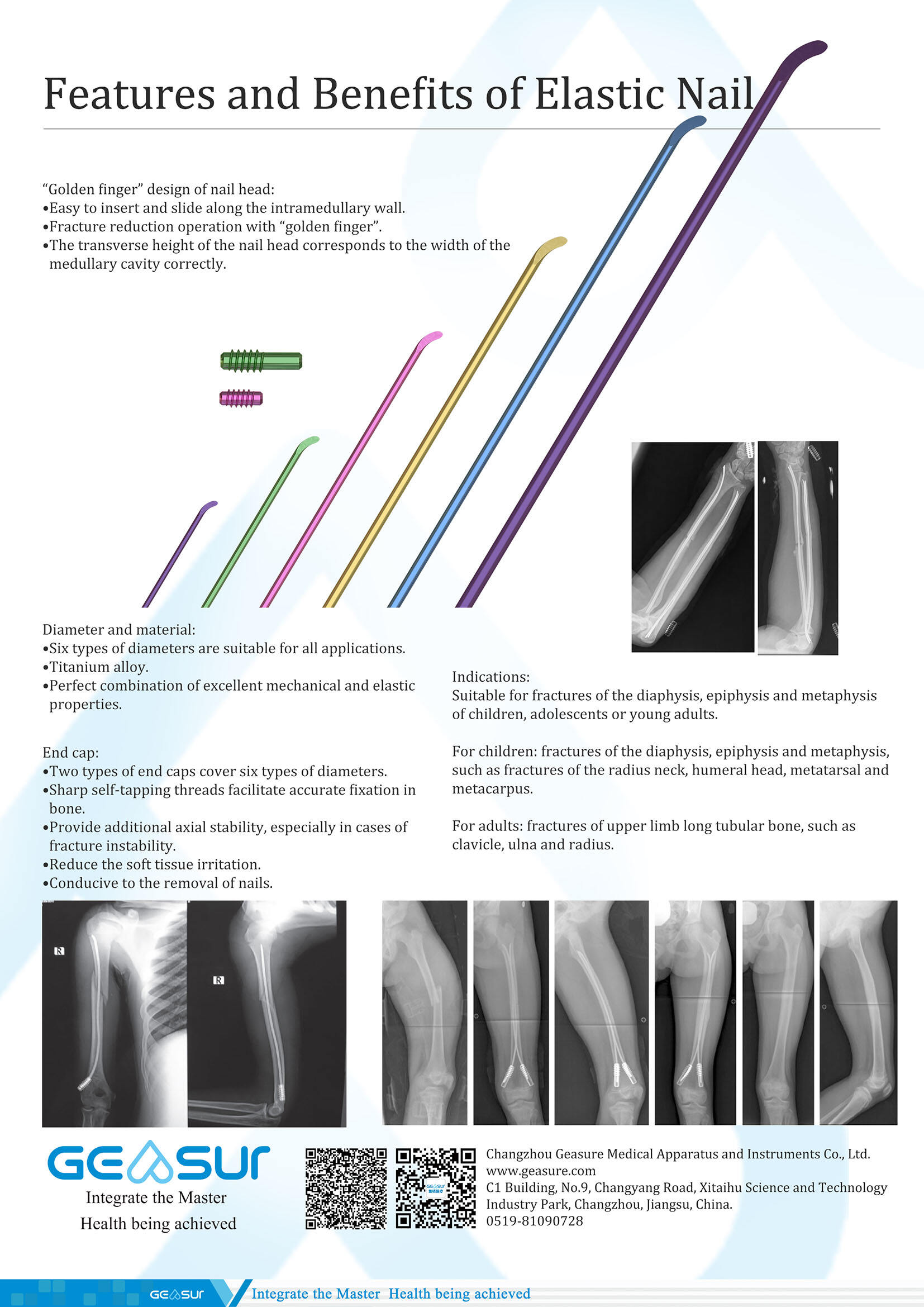 弹性髓内钉背 副本.jpg