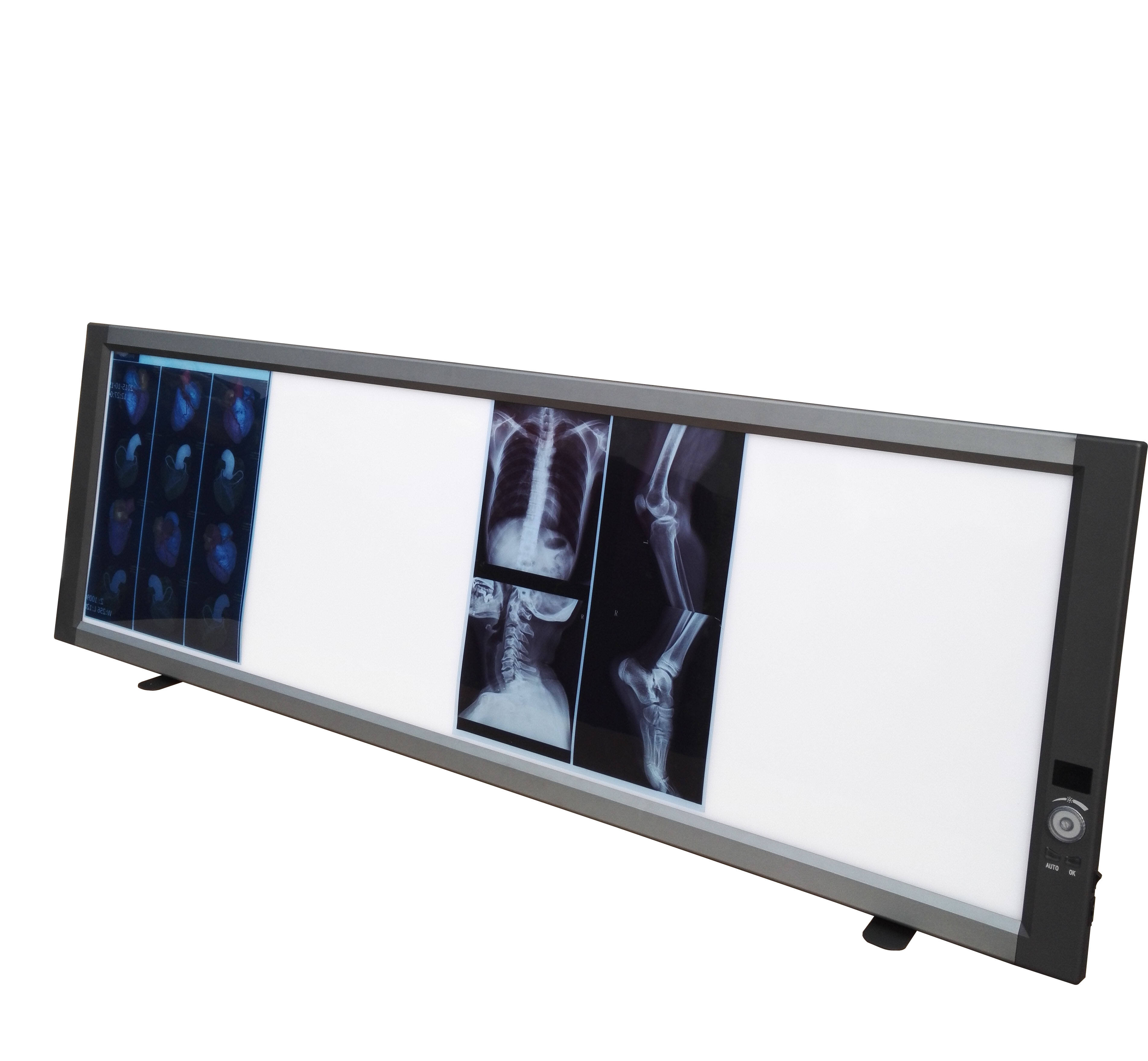 Medical Double Medical X Ray Film Viewer Medical Led X-Ray Flim Viewer Instrument Digital Film Viewer Dental Negatoscope Box details