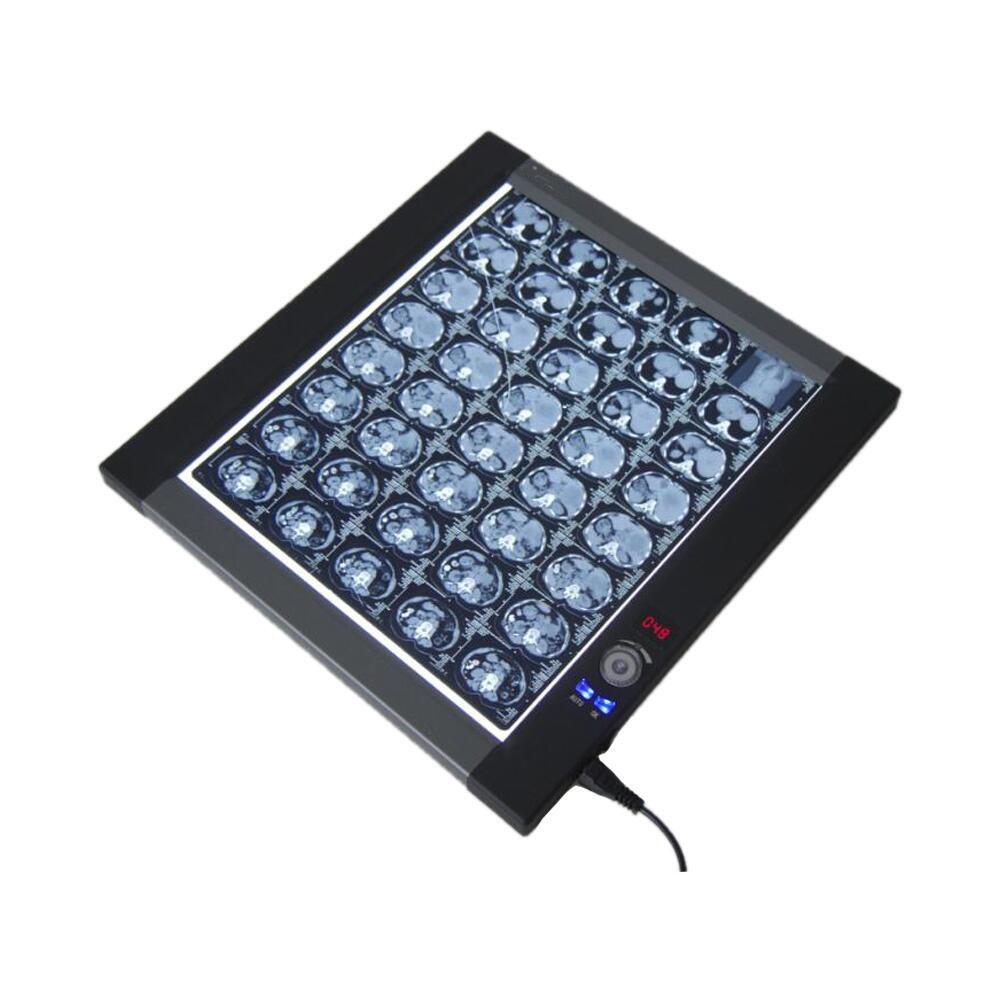 Medical Double Medical X Ray Film Viewer Medical Led X-Ray Flim Viewer Instrument Digital Film Viewer Dental Negatoscope Box manufacture