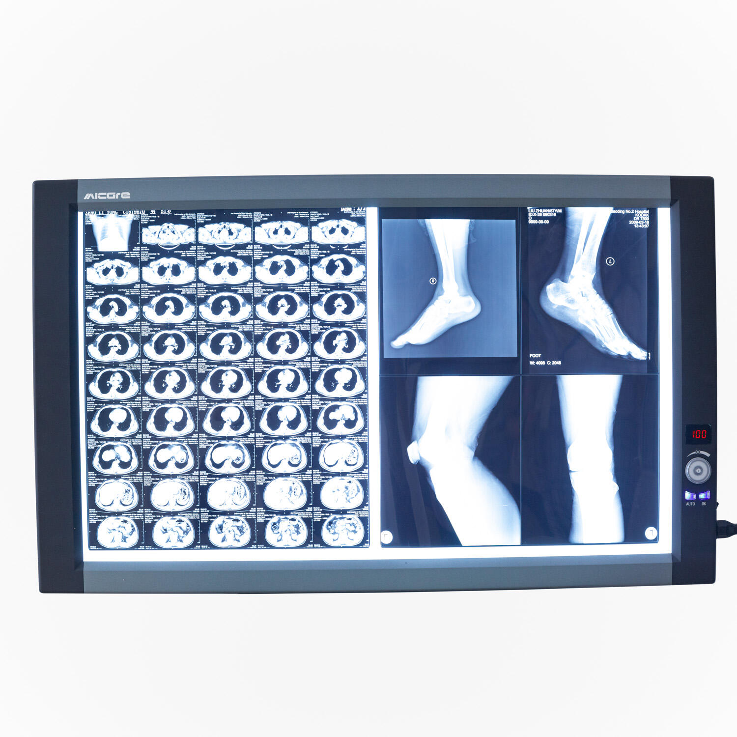 Medical Double Medical X Ray Film Viewer Medical Led X-Ray Flim Viewer Instrument Digital Film Viewer Dental Negatoscope Box factory