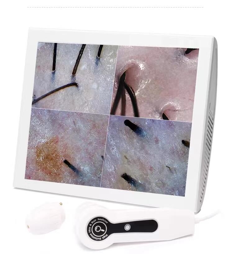 2024 New 15-inch digital HD test hair follicles to detect skin problems manufacture
