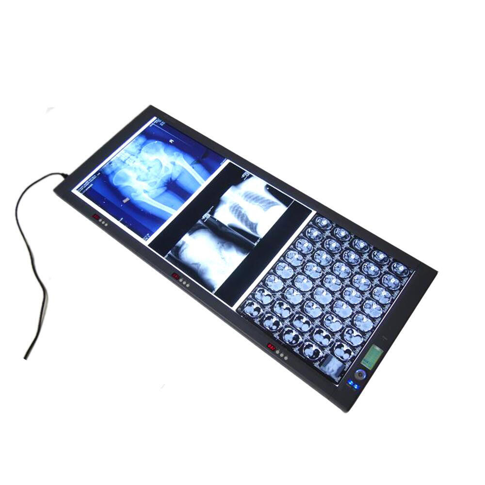 Medical Double Medical X Ray Film Viewer Medical Led X-Ray Flim Viewer Instrument Digital Film Viewer Dental Negatoscope Box details