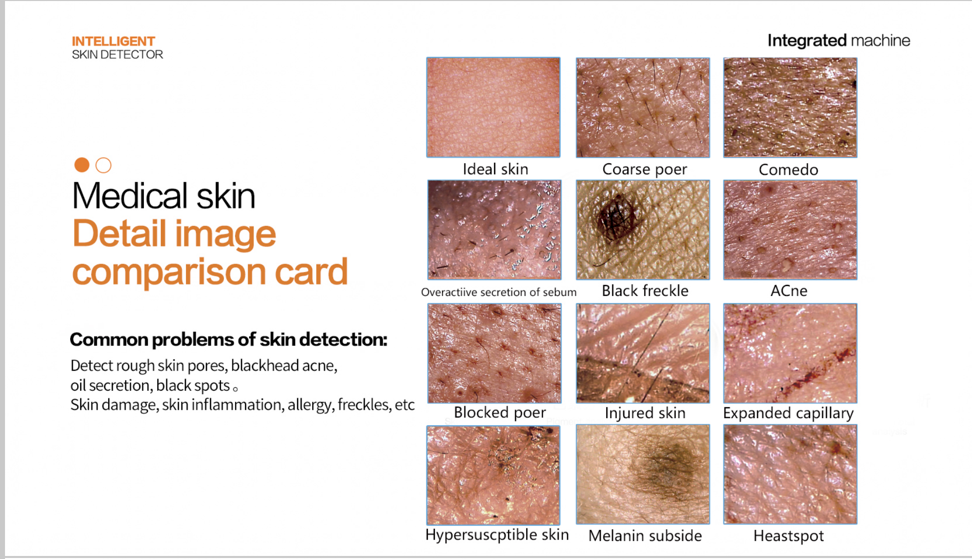 The BV portable HD dual probe detector can analyze scalp hair follicles as well as skin details