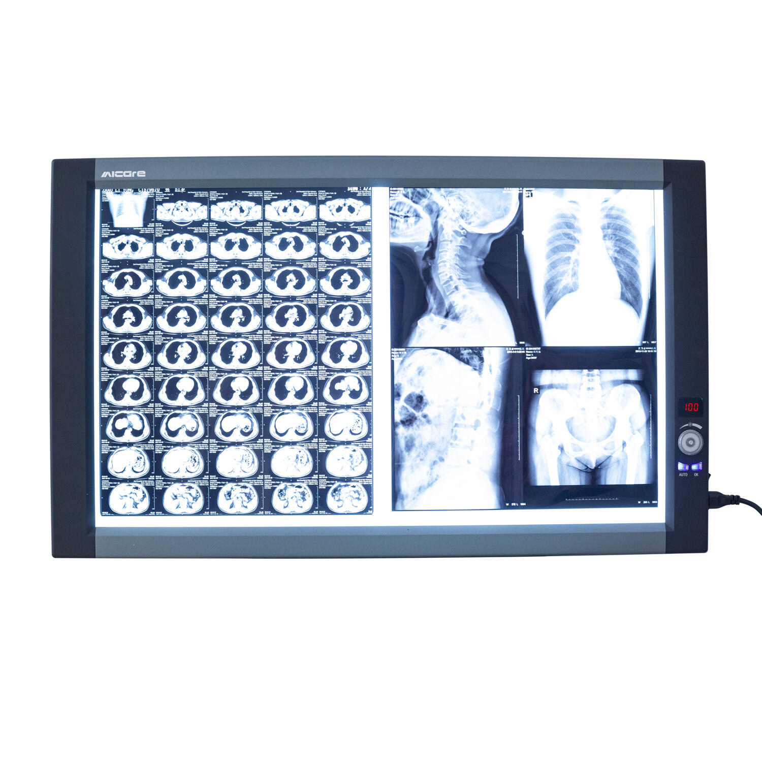 Visualizzatore di pellicole a raggi X medico doppio Visualizzatore di pellicole a raggi X a LED medico Visualizzatore di pellicole digitali Negatoscopio dentale Dettagli della scatola